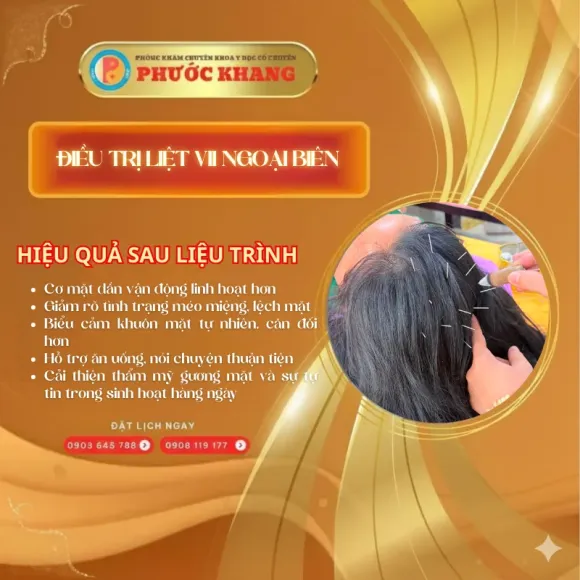 ĐIỀU TRỊ VẸO CỘT SỐNG